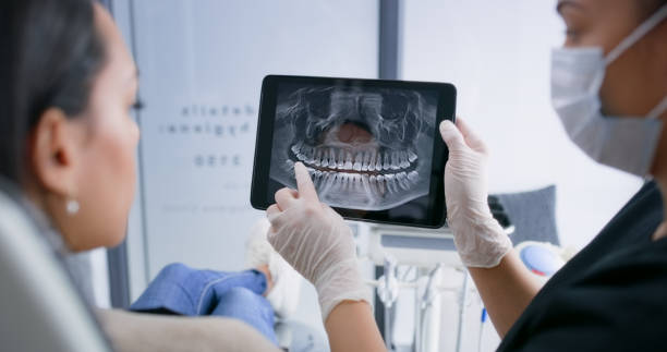 Licensed Root Canal Treatment service in New Smyrna Beach, FL - Smile Center Dentistry